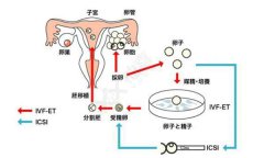 试管婴儿移植后需要多久能着床？要怎么样才能确定怀孕