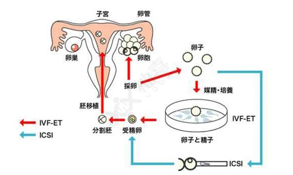 试管婴儿移植后需要多久能着床？要怎么样才能确定怀孕