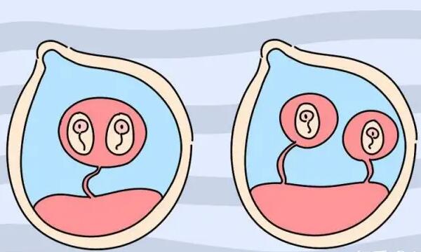 试管移植单胚er双胚胎，过来人告诉你选择哪个比较好！