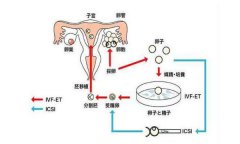 试管科普 |试管婴儿全流程指南，看完必懂！