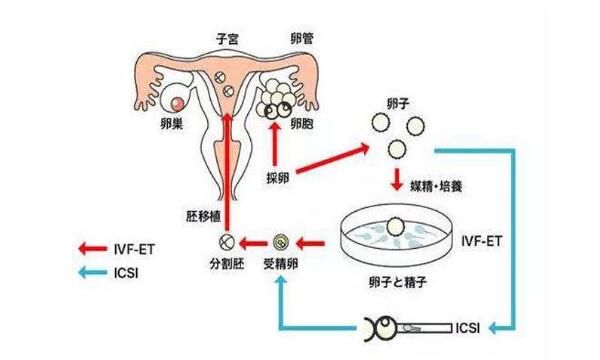 试管科普 |试管婴儿全流程指南，看完必懂！